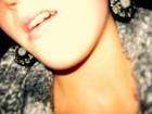 Hense