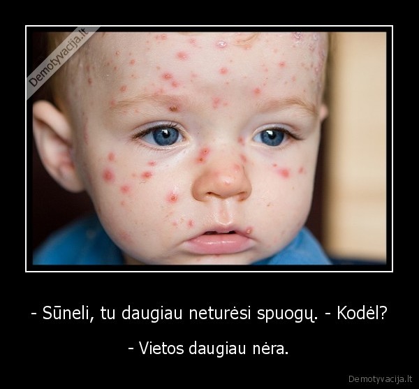 - Sūneli, tu daugiau neturėsi spuogų. - Kodėl?