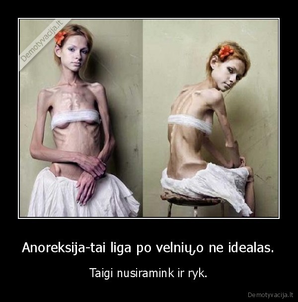 Anoreksija-tai liga po velnių,o ne idealas.