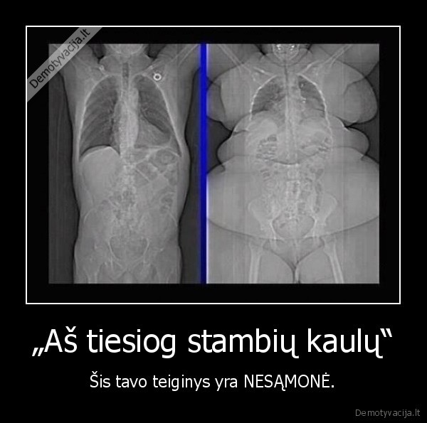 „Aš tiesiog stambių kaulų“