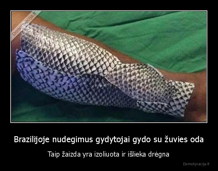 zaizda,nudegimas,brazilija,koja,zuvis