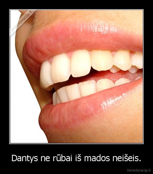 Dantys ne rūbai iš mados neišeis.