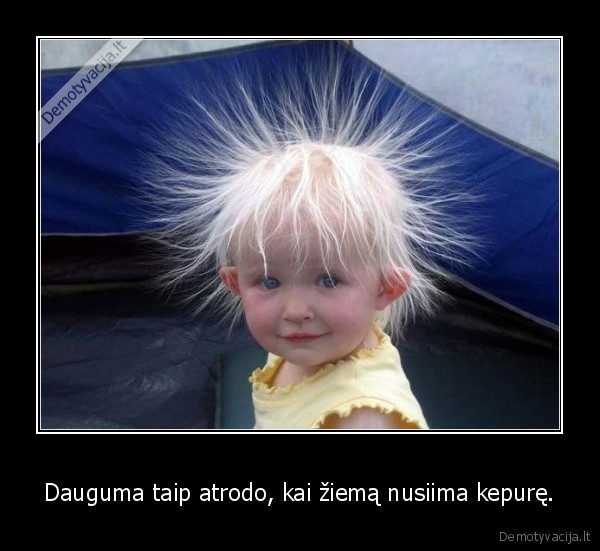 Dauguma taip atrodo, kai žiemą nusiima kepurę.