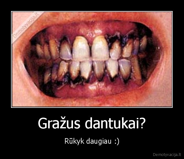 Gražus dantukai?