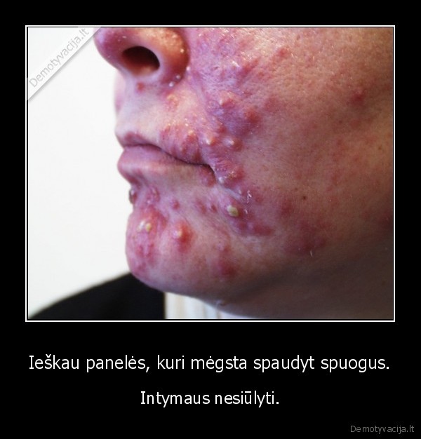 spuogai, meile, vaikinas, mergina, ieskau, draugyste