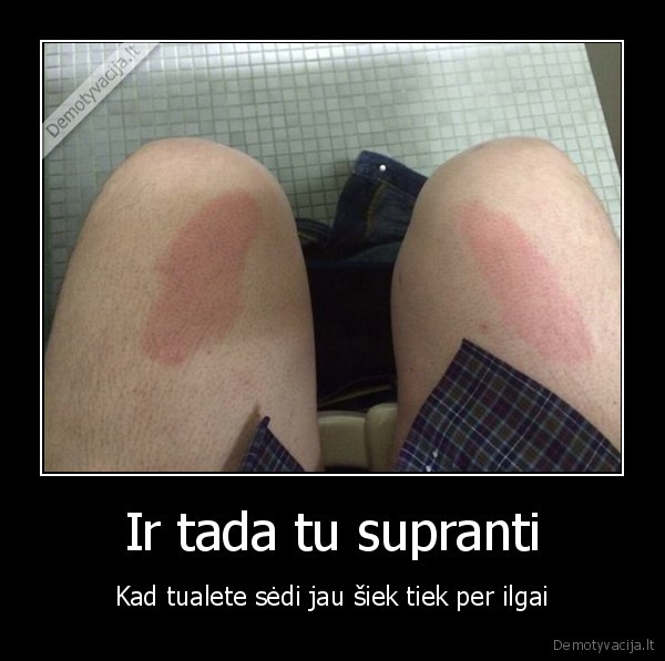 sedi, tualete,sika,anstpaudai