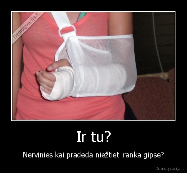 gipsas, niezulys, ranka