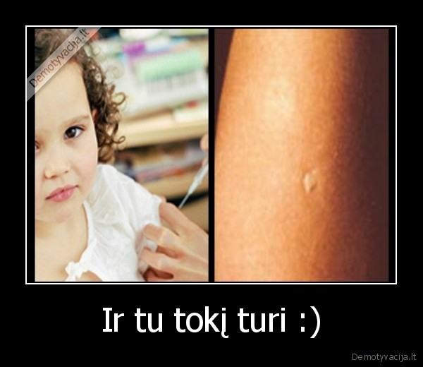 Ir tu tokį turi :)