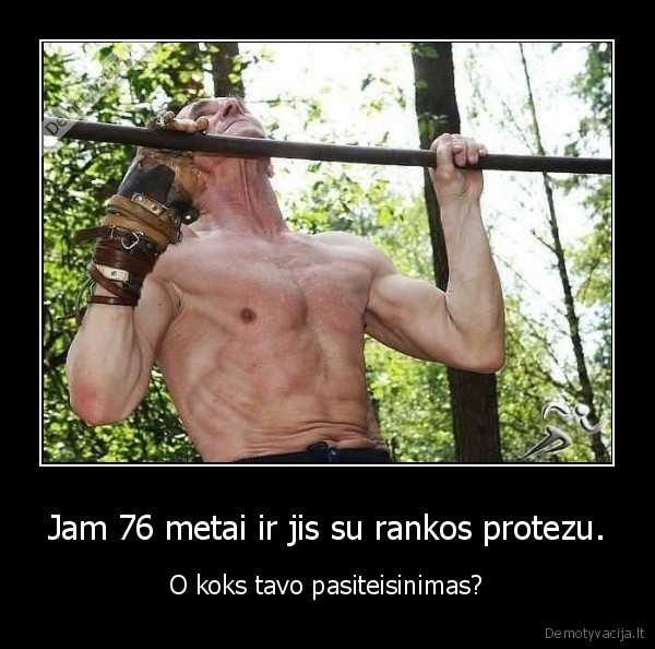 Jam 76 metai ir jis su rankos protezu.