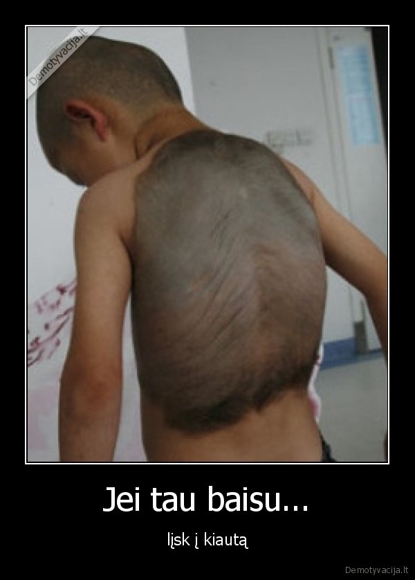 Jei tau baisu...