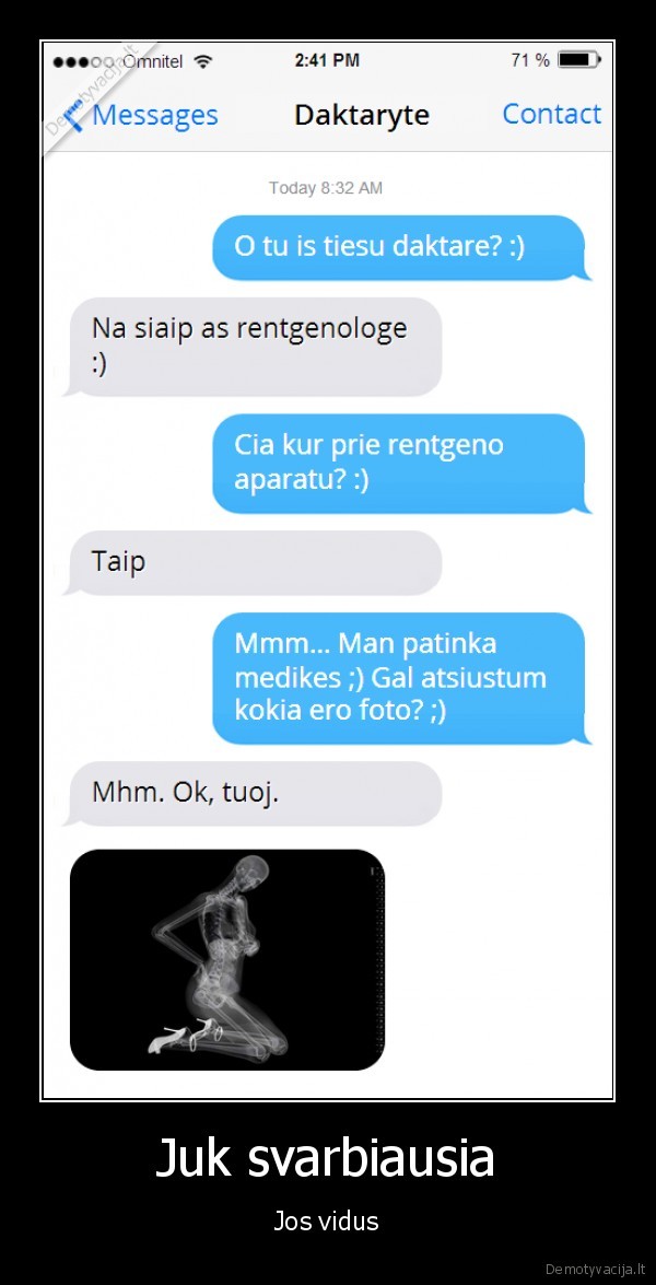 rentgeno, nuotrauka,sms, merginai,sms, pazintis