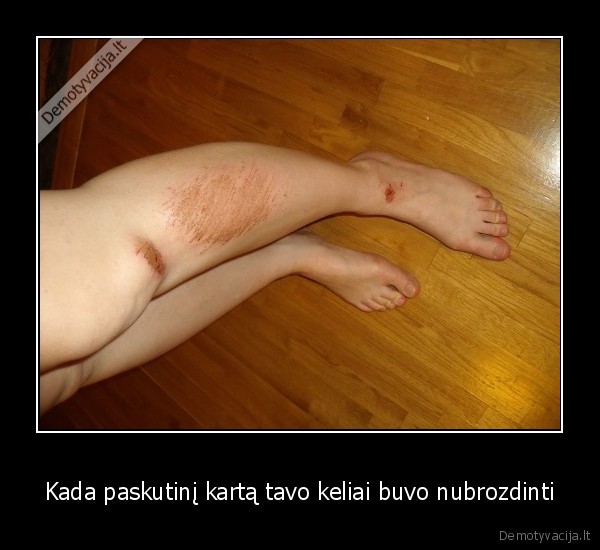 Kada paskutinį kartą tavo keliai buvo nubrozdinti
