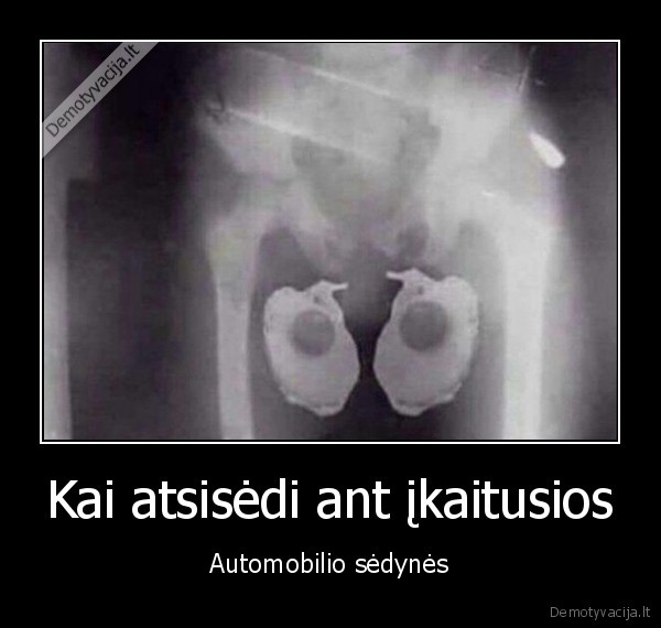 kiausiniene,dega, kiausai