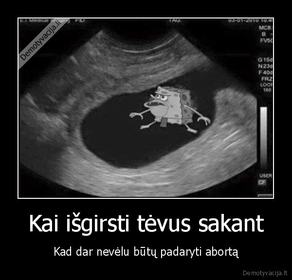 abortas,vaisius