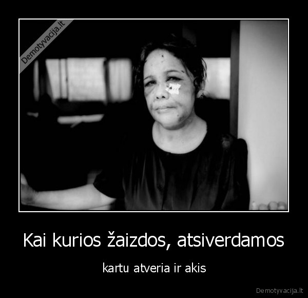 smurtas,fizinis,psichologinis,zaizda