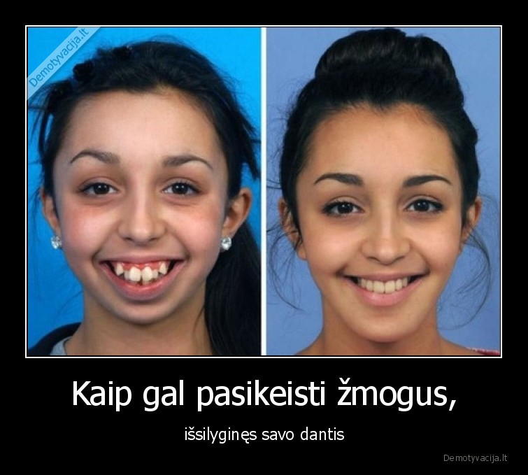 mergina,dantys,pries,po,wow