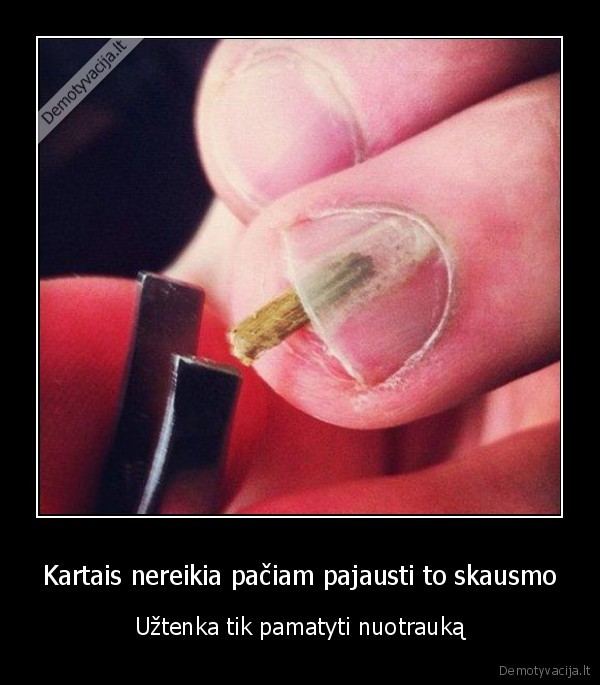 nuotrauka,paziurejus,paciam,skauda