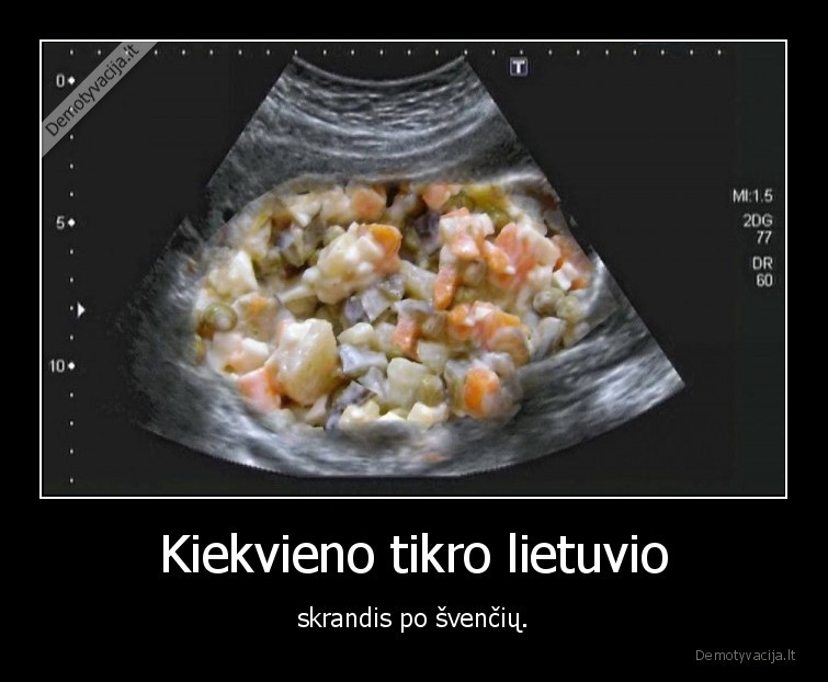 lietuvis,skrandis,balta, misraine