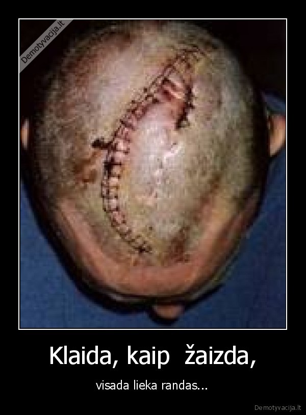 klaidos