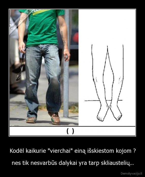 vierchai,kojos,isskiestos,skliausteliai