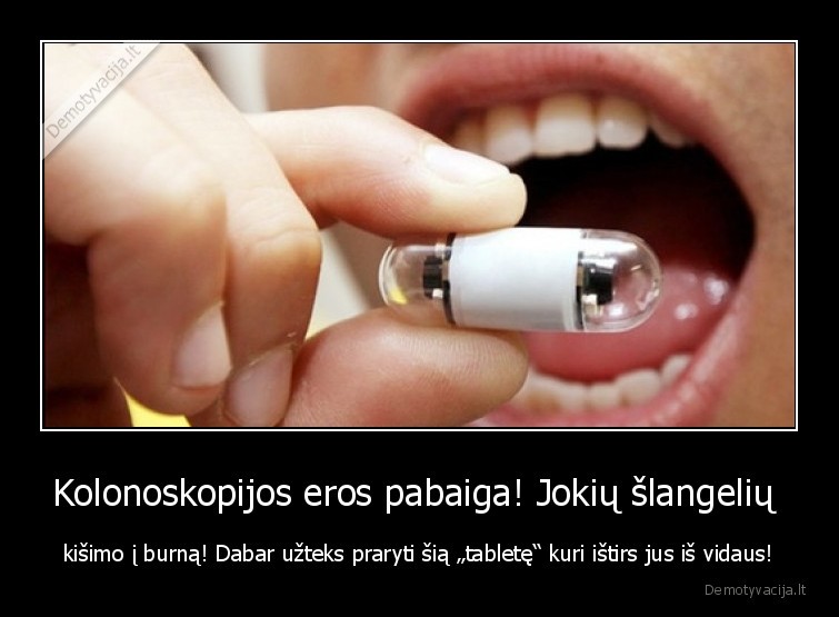 kolonoskopija,burna,technologijos