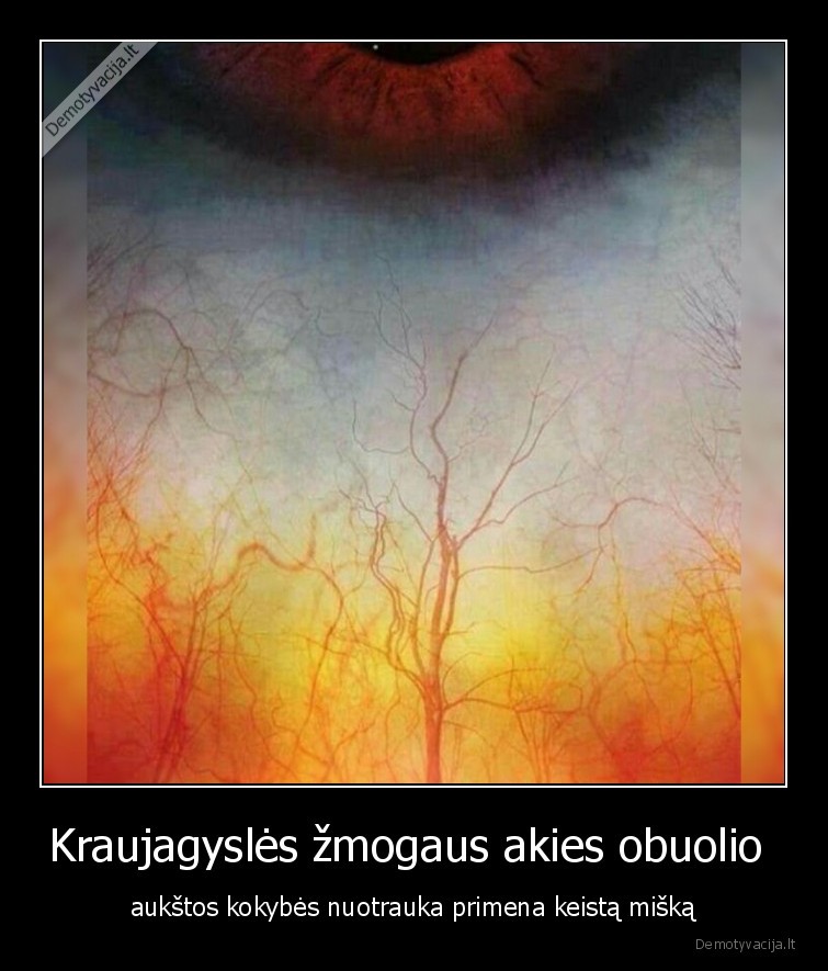 idomybes,nuotrauka,akis,akies, obuolys,keistas, miskas