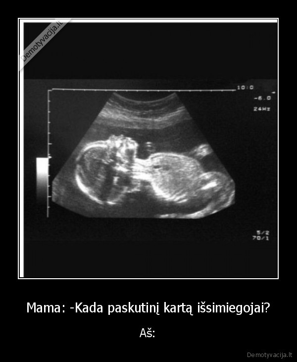 miegas