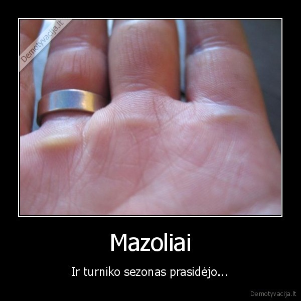 Mazoliai