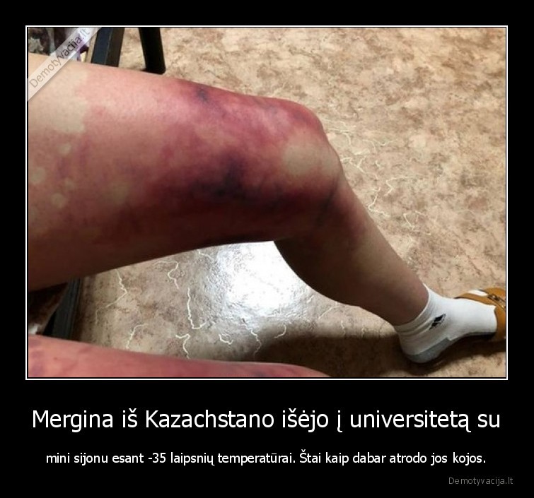 moteriska, logika,baisios, kojos