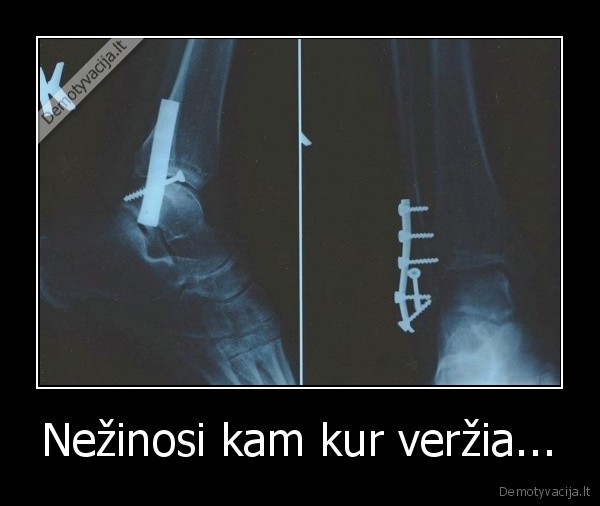 varztas,koja,verzia,rutoji