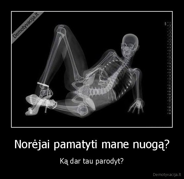 nuga,kaulai,rentgenas
