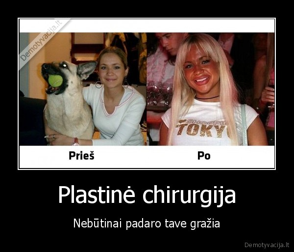 Plastinė chirurgija