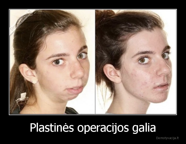 galia,operacija,pries,po
