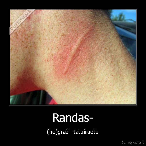 Randas-
