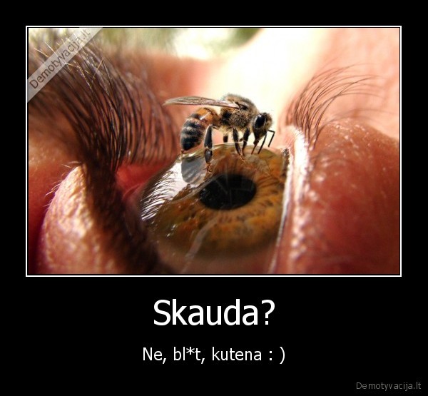 Skauda?
