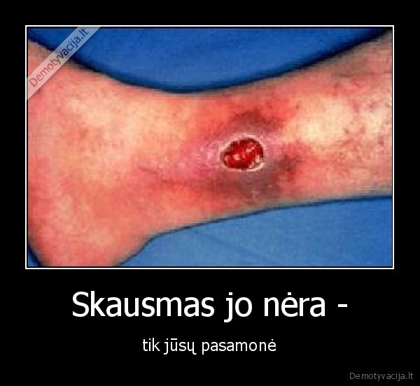 skausmas