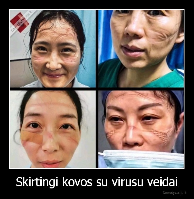 kova,virusas,korona