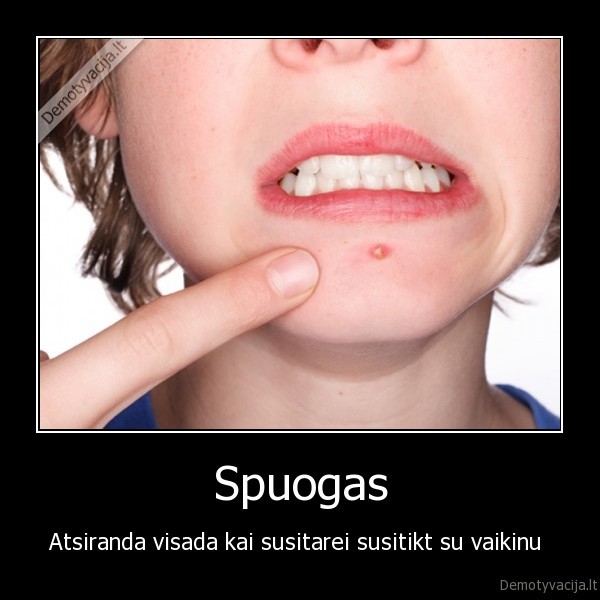 Spuogas