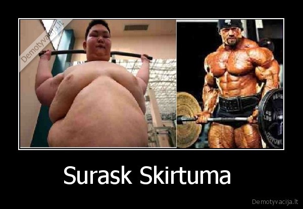 Surask Skirtuma 