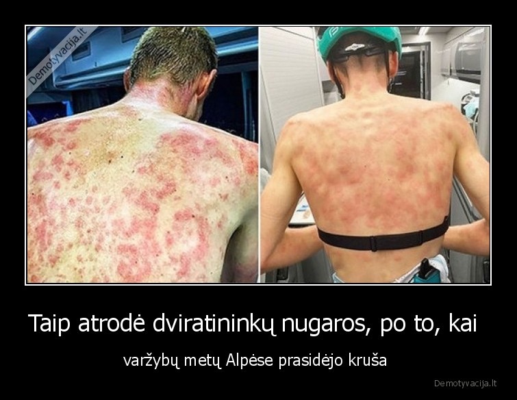 dviratininkai,krusa,nugaros,sportas
