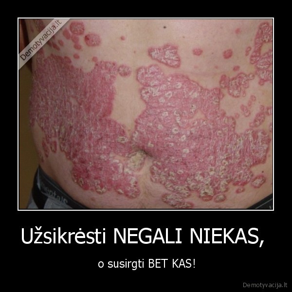 Užsikrėsti NEGALI NIEKAS, 