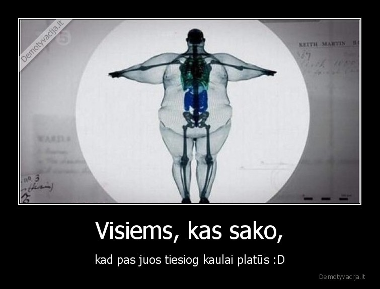 storas,platus, kaulai,dideli, kaulai