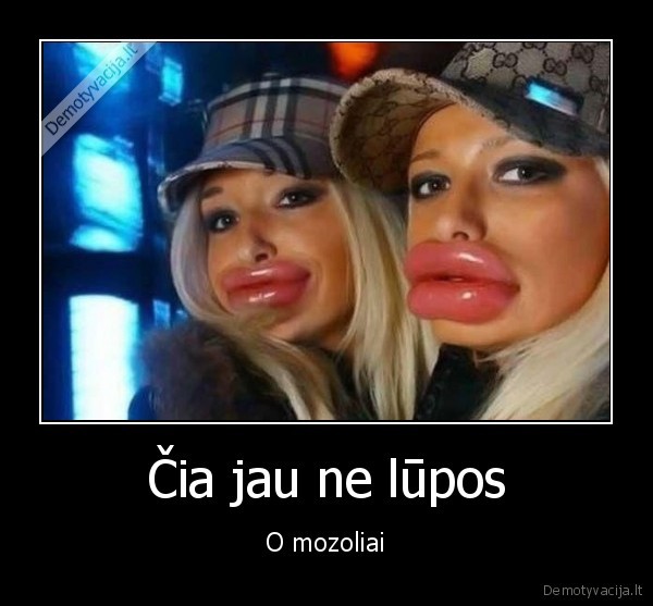 mozoliai,lupos