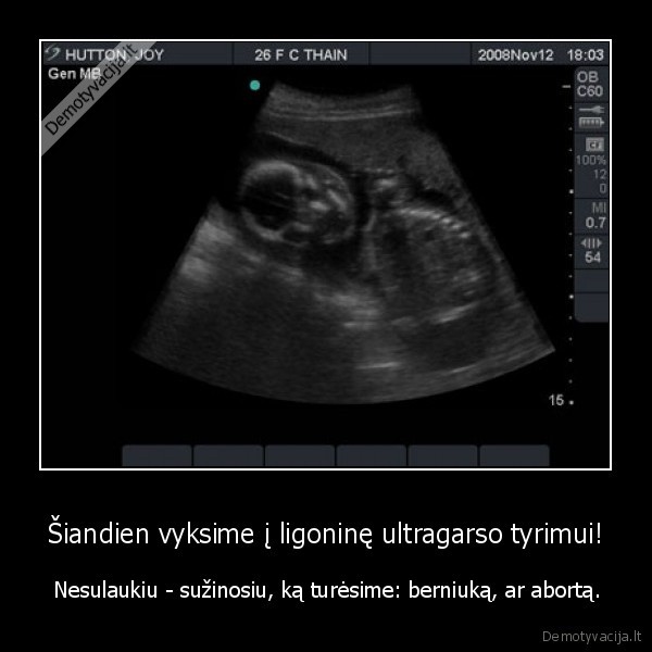 ultra,garsas