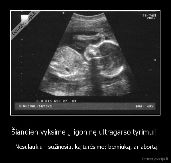 Šiandien vyksime į ligoninę ultragarso tyrimui! 