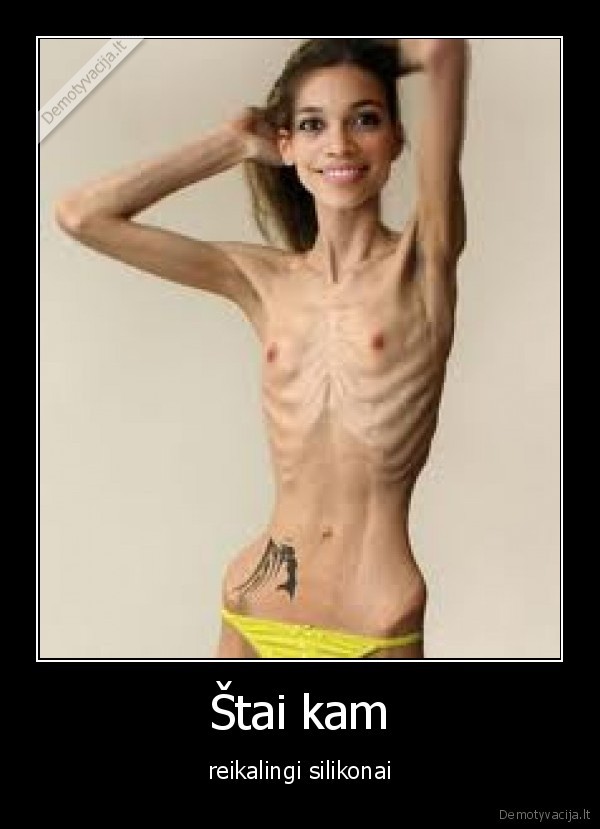 Štai kam