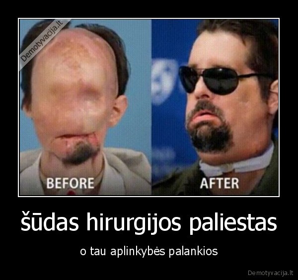 šūdas hirurgijos paliestas