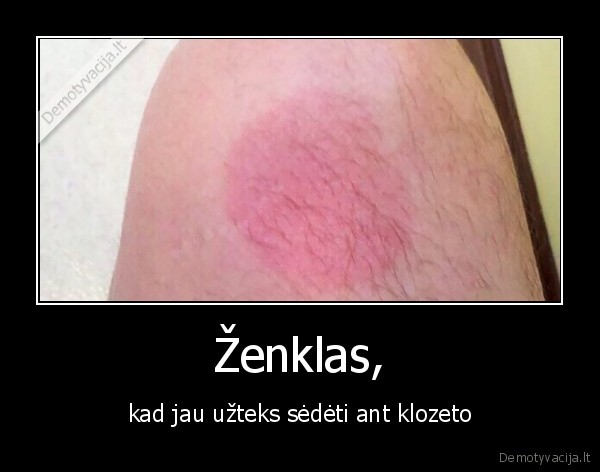 sedeti,wc,zenklas