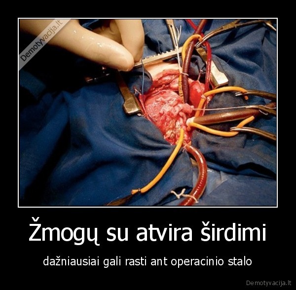Žmogų su atvira širdimi