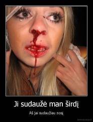 Ji sudaužė man širdį - Aš jai sudaužiau nosį